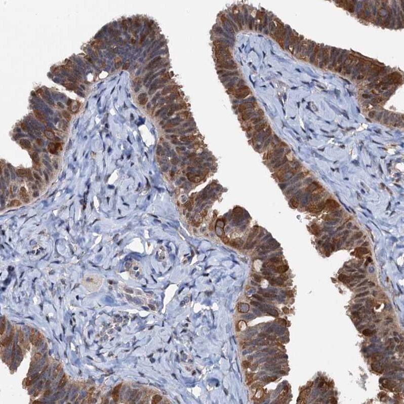 Staining of human fallopian tube shows strong nuclear and cytoplasmic positivity in glandular cells.