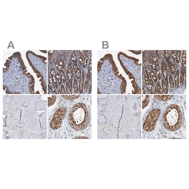 <b>Orthogonal Strategies Validation. </b>Staining of human fallopian tube, gastrointestinal, skeletal muscle and testis HPA038672 (A) shows similar protein distribution across tissues to independent antibody HPA038673 (B).