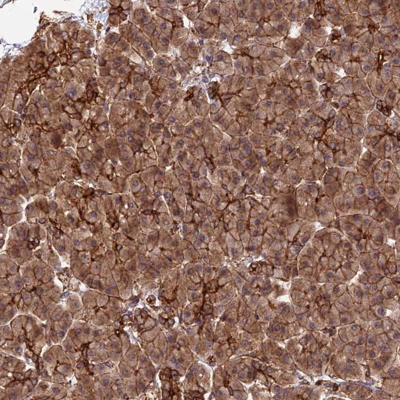 Immunohistochemistry-Paraffin HOMER2 Antibody - BSA Free