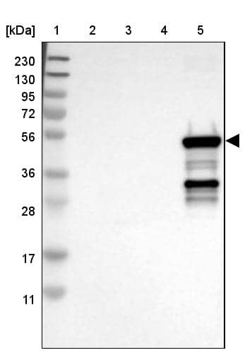 Lane 1: Marker [kDa] 230, 130, 95, 72, 56, 36, 28, 17, 11Lane 2: Human cell line RT-4Lane 3: Human cell line U-251MG Lane 4: Human plasma (IgG/HSA depleted)Lane 5: Human liver tissue