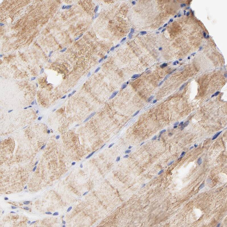 Staining of human skeletal muscle shows moderate cytoplasmic positivity in myocytes.