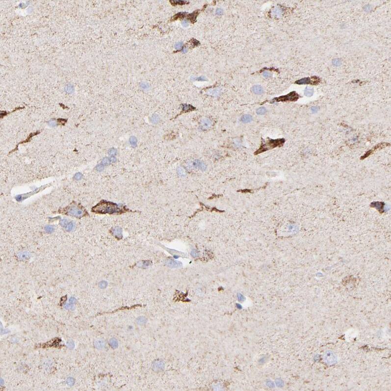 Staining of human cerebral cortex shows strong cytoplasmic /cytoplasmic granular positivity in neuronal cells.