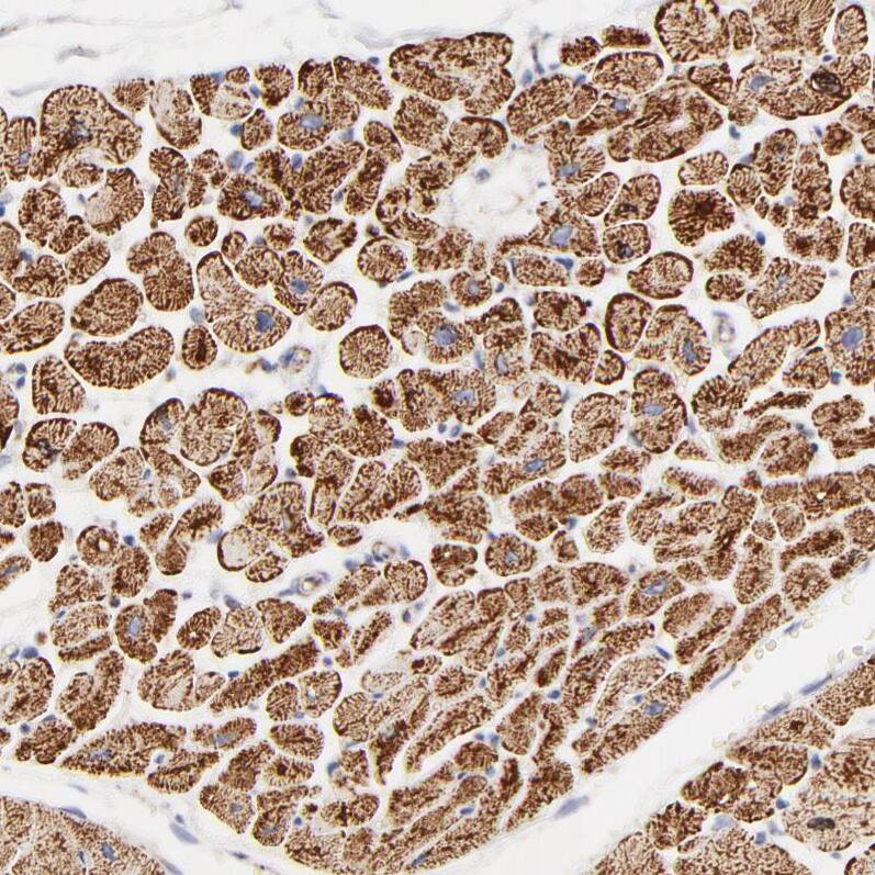 Staining of human heart muscle shows strong cytoplasmic/cytoplasmic granular positivity in cardiomyocytes.