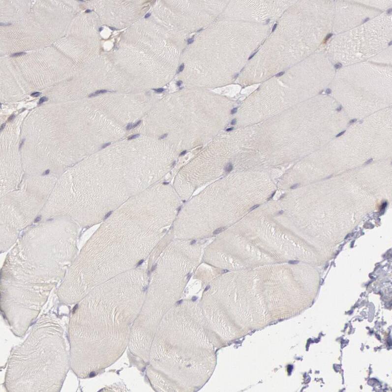 Staining of human skeletal muscle shows no positivity in myocytes as expected.