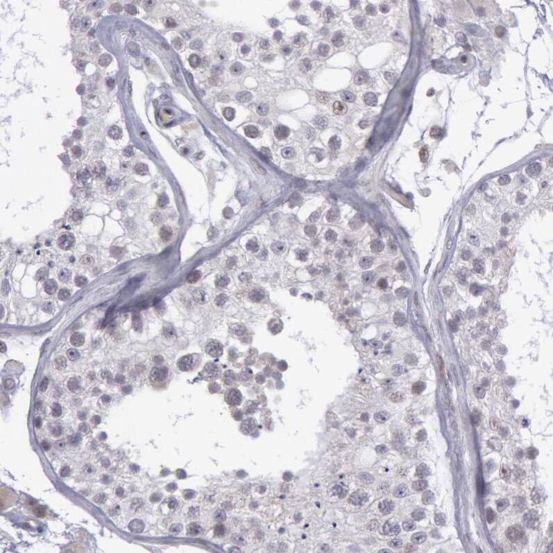 Staining of human testis shows no positivity in cells in seminiferous ducts as expected.