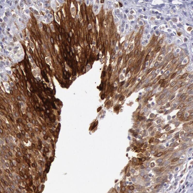 Staining of human urinary bladder shows strong cytoplasmic positivity in urothelial cells.