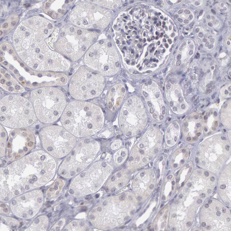 Staining of human kidney shows no positivity in cells in tubules and cells in glomeruli as expected.