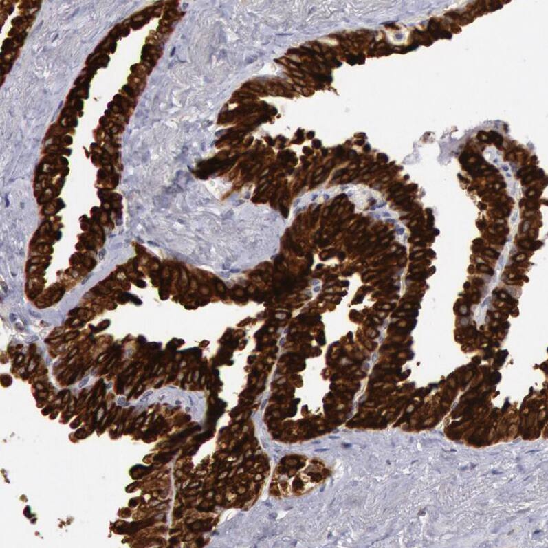 Staining of human seminal vesicle shows strong cytoplasmic positivity in glandular cells.