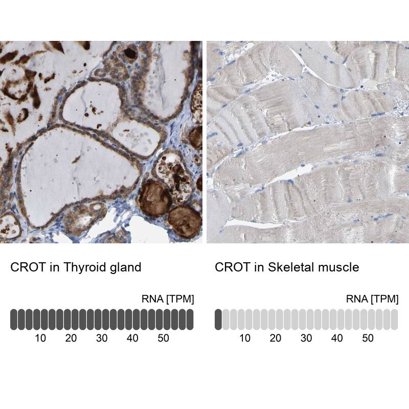 <b>Orthogonal Strategies Validation. </b>Analysis in human thyroid gland and skeletal muscle tissues.