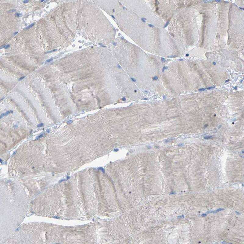 Staining of human skeletal muscle shows low expression as expected.