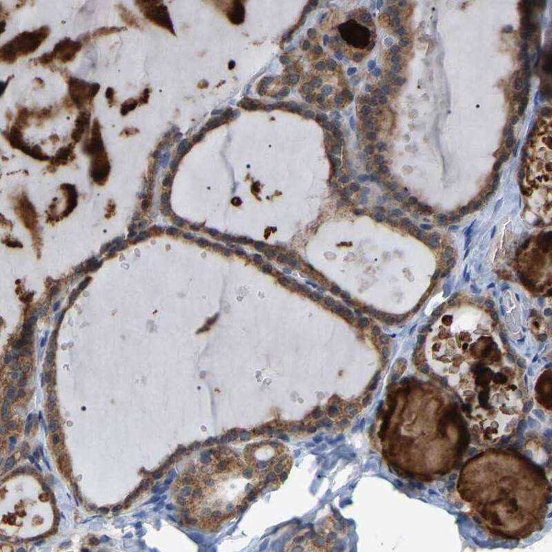 Staining of human thyroid gland shows high expression.