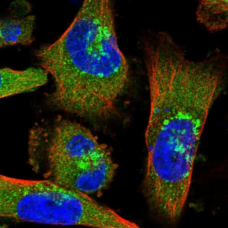Staining of human cell line U-251 MG shows localization to cytosol, the Golgi apparatus & vesicles.