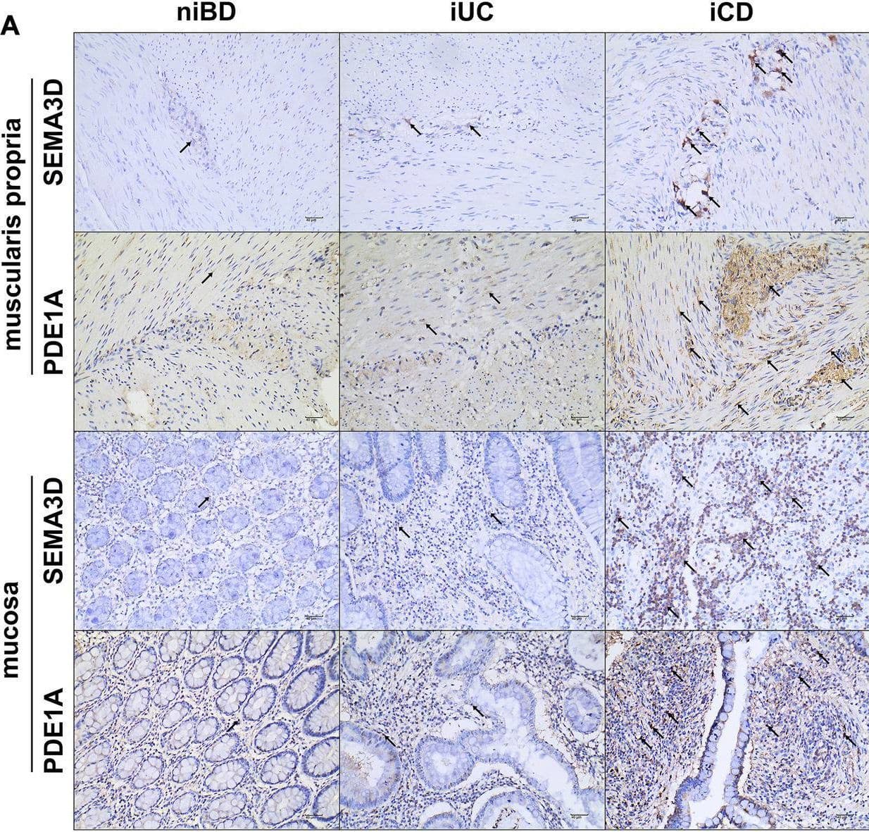 Abundant expression of SEMA3D and PDE1A proteins in layers of muscularis propria and mucosa in inflamed CD specimens. (A) Immunohistochemistry (IHC) images showing representative colon specimens from patients with CD and UC, including non-inflammatory and inflammatory samples. Staining demonstrates expression of SEMA3D and PDE1A at a magnification of ×20. The scale bar corresponds to 40 μm. (B,C) Graphs presenting the quantification of staining (percentage of DAB-positive tissue) in niBD, iUC, and iCD cohorts (niBD, n = 4; iUC, n = 7; iCD, n = 15). Statistical analysis was performed using Fisher’s LSD test. Nonsignificant p-values (>0.05) are denoted. Asterisks (*) indicate statistical significance levels: *p ≤ 0.05, **p ≤ 0.01. Image collected and cropped by CiteAb from the following open publication (//pubmed.ncbi.nlm.nih.gov/37727374), licensed under a CC-BY license. Not internally tested by Novus Biologicals.