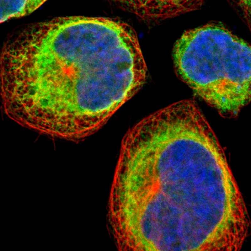 Staining of human cell line A-431 shows localization to endoplasmic reticulum.