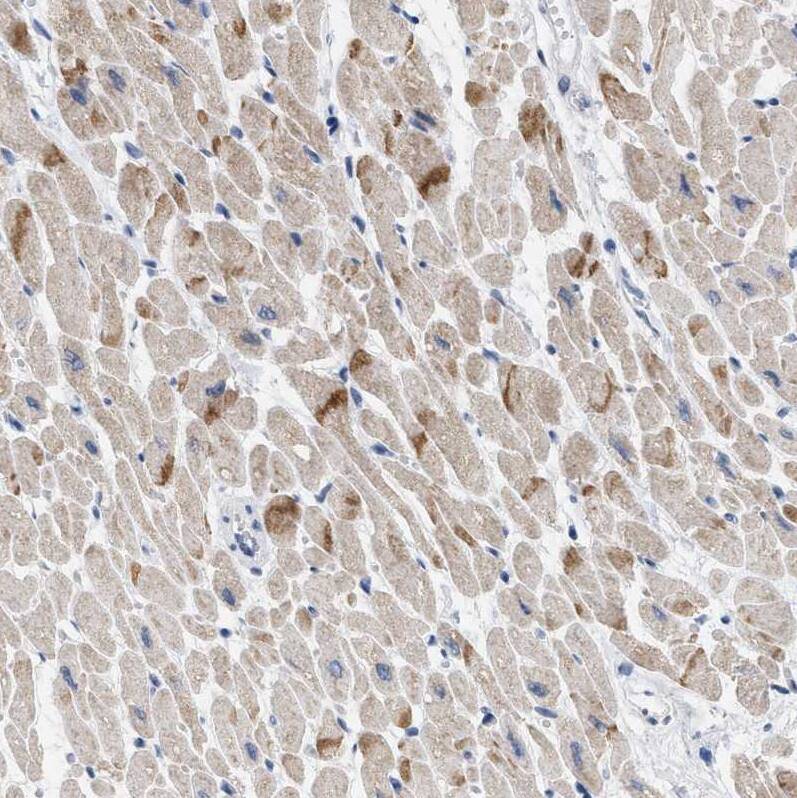 Staining of human heart muscle shows moderate positivity in intercalated discs.
