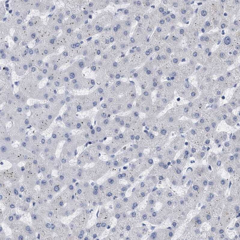 Staining of human liver shows no positivity in hepatocytes as expected.