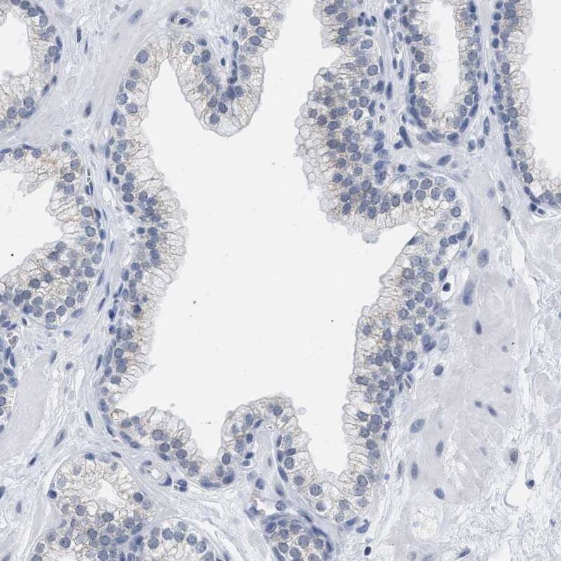 Staining of human prostate shows no positivity in glandular cells as expected.