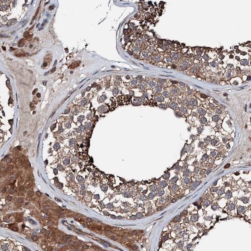 Staining of human testis shows distinct cytoplasmic positivity in cells in seminiferous ducts and Leydig cells.