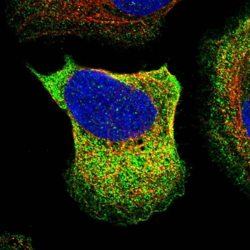 Staining of human cell line U-2 OS shows localization to cytosol.