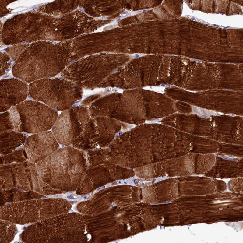 Immunohistochemistry-Paraffin Rapsyn Antibody - BSA Free