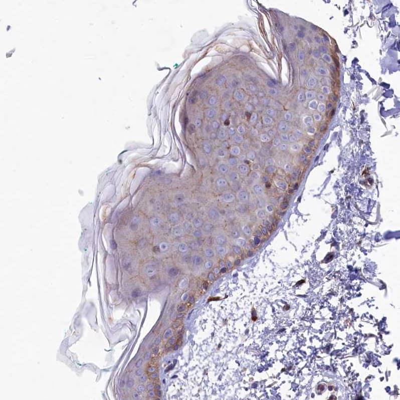 Immunohistochemistry-Paraffin Rapsyn Antibody - BSA Free