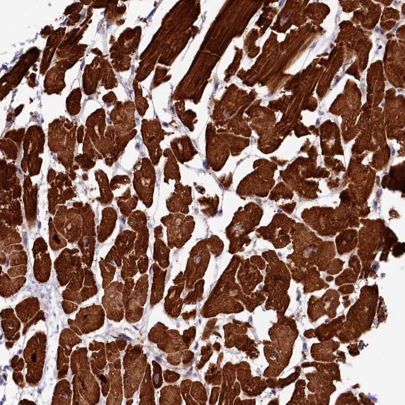 Staining of human heart muscle shows strong cytoplasmic positivity in cardiomyocytes.