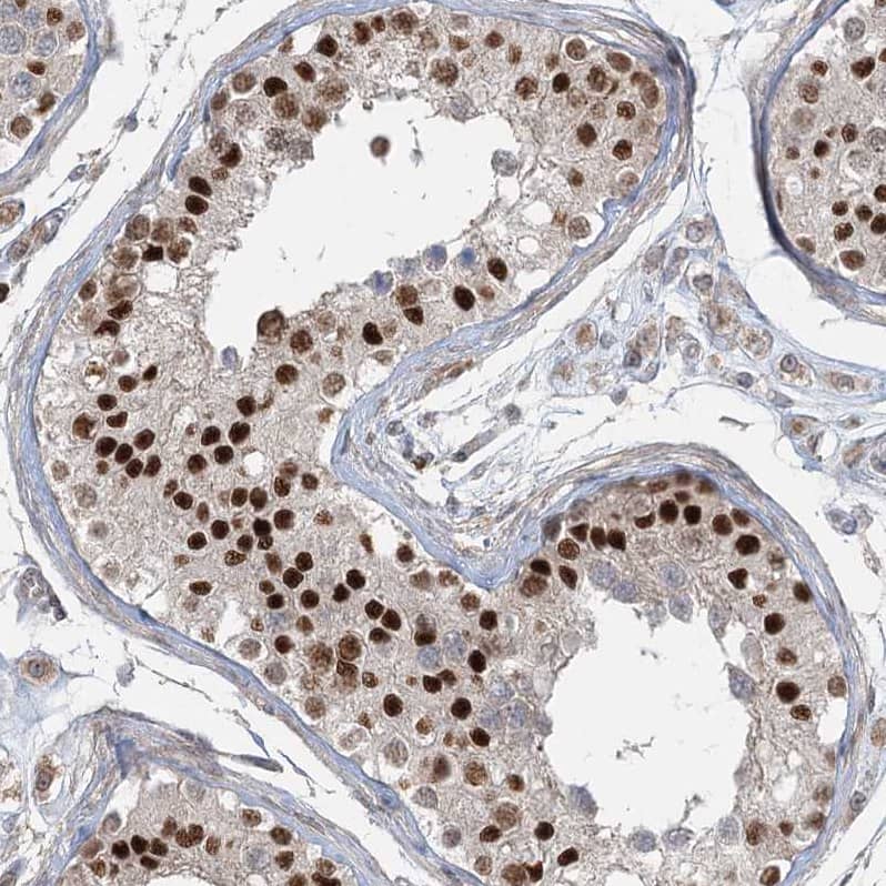 Immunohistochemistry-Paraffin ZNF711 Antibody - BSA Free