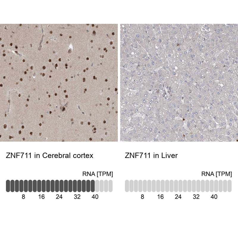 Immunohistochemistry-Paraffin ZNF711 Antibody - BSA Free