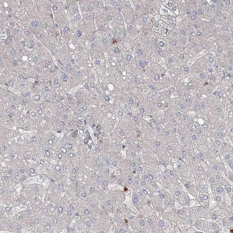 Immunohistochemistry-Paraffin ZNF711 Antibody - BSA Free