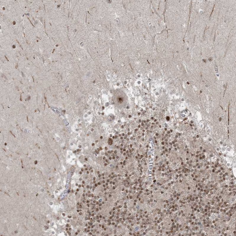 Immunohistochemistry-Paraffin ZNF711 Antibody - BSA Free