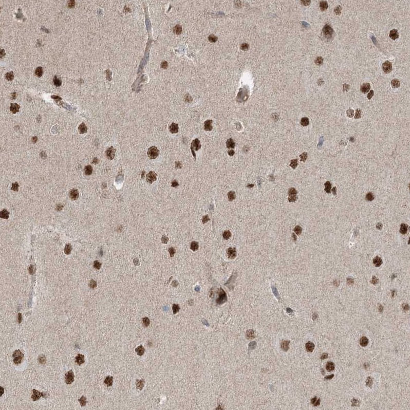 Immunohistochemistry-Paraffin ZNF711 Antibody - BSA Free