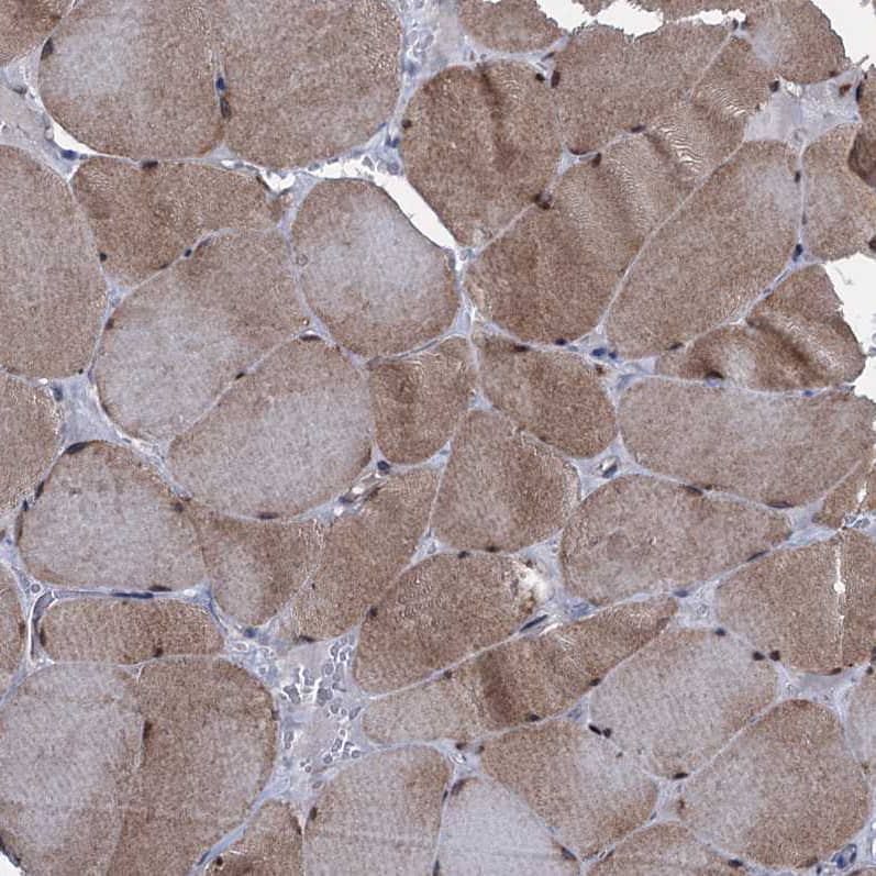 Immunohistochemistry-Paraffin EYA4 Antibody - BSA Free