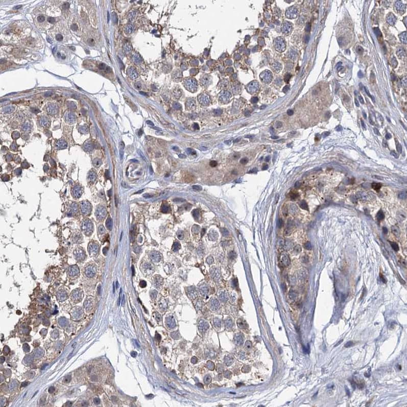 Immunohistochemistry-Paraffin EYA4 Antibody - BSA Free