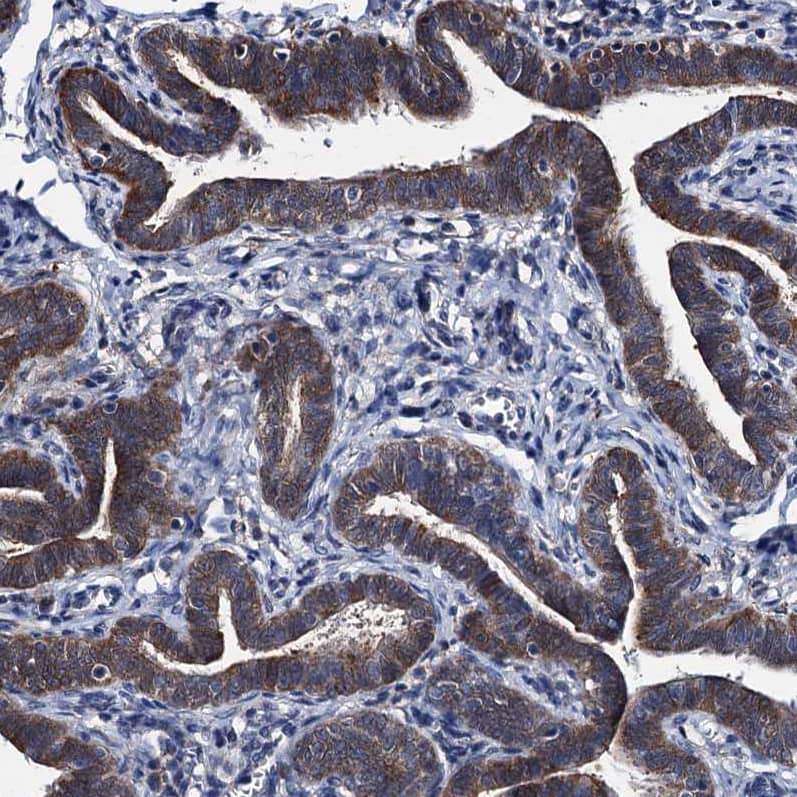 Immunohistochemistry-Paraffin EYA4 Antibody - BSA Free