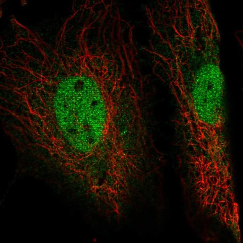 Staining of human cell line HeLa shows localization to nucleoplasm.