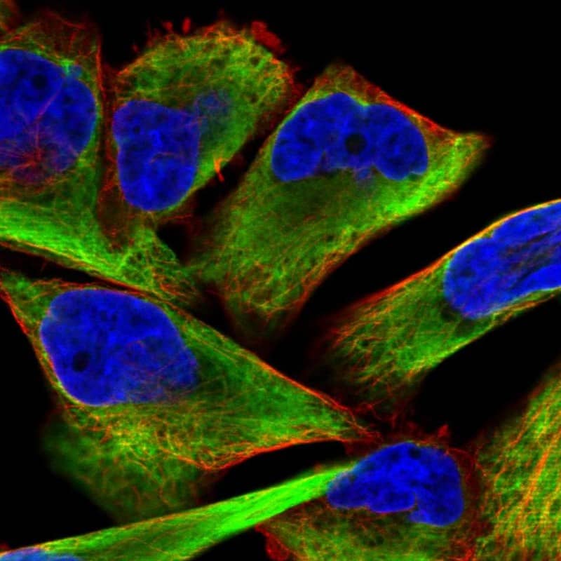 Staining of human cell line RH-30 shows localization to intermediate filaments.