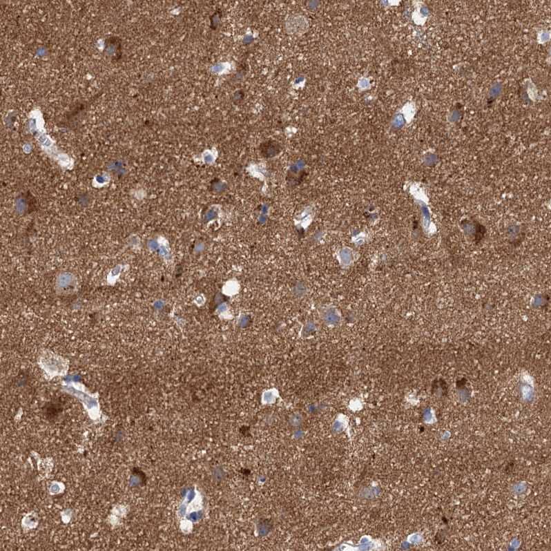 Immunohistochemistry-Paraffin NLRP10/Pynod/NALP10 Antibody - BSA Free