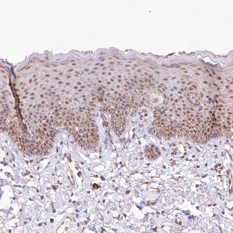 Staining of human skin shows moderate nuclear positivity in squamous epithelial cells.
