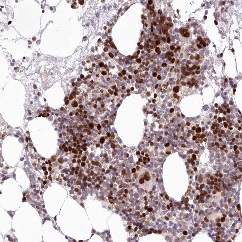 Staining of human bone marrow shows strong nuclear positivity in a subset of hematopoietic cells.