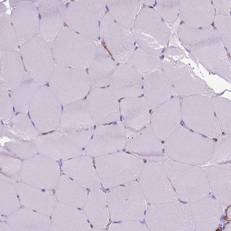 Staining of human skeletal muscle shows no positivity in myocytes as expected.