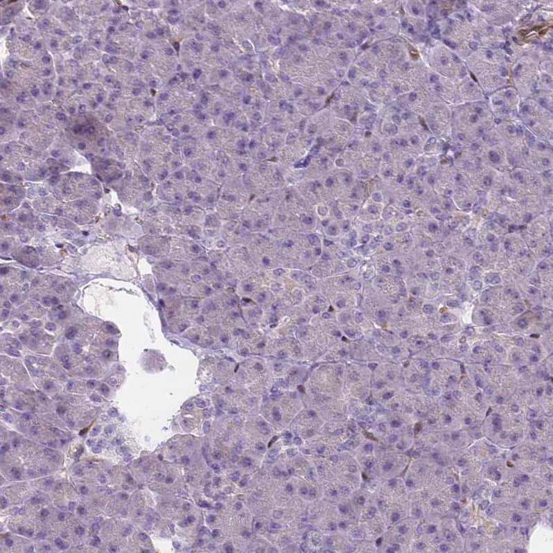 Immunohistochemistry-Paraffin CLIC4 Antibody - BSA Free