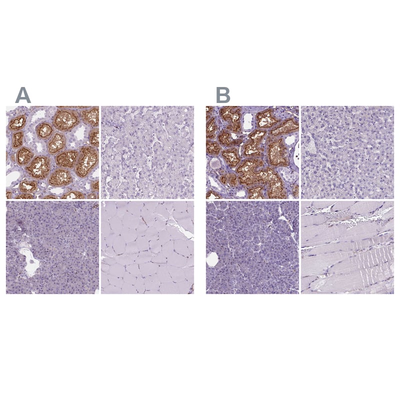 <b>Independent Antibodies Validation. </b>Staining of human kidney, liver, pancreas and skeletal muscle using Anti-CLIC4 antibody NBP1-85574 (A) shows similar protein distribution across tissues to independent antibody NBP2-49321 (B).