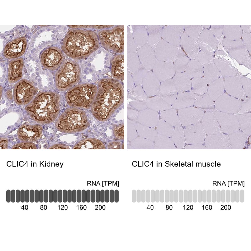 Immunohistochemistry analysis in human kidney and skeletal muscle tissues using HPA008019 antibody. Corresponding CLIC4 RNA-seq data are presented for the same tissues.