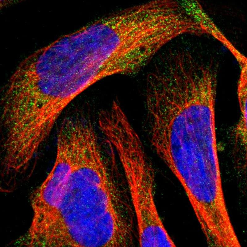Staining of human cell line U-2 OS shows localization to cytosol.