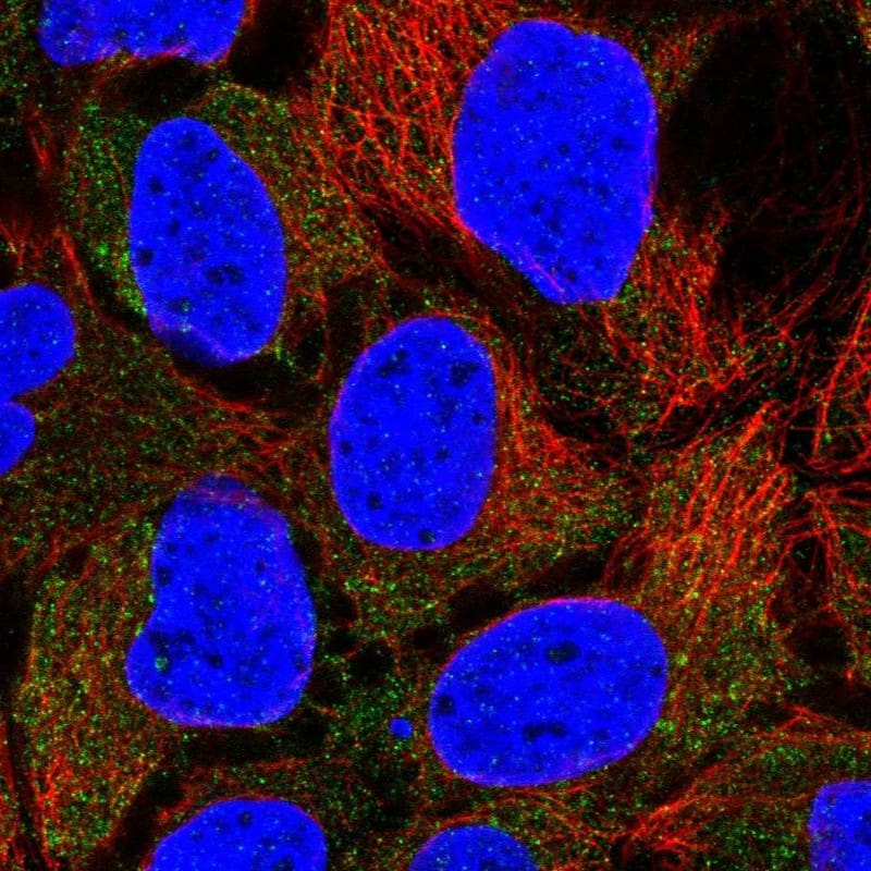 Staining of human cell line CACO-2 shows localization to cytosol.