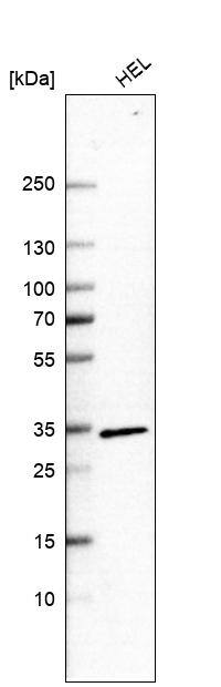 Analysis in human cell line HEL.
