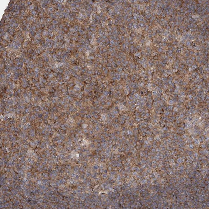 Staining of human lymph node shows moderate membranous positivity in germinal center cells.