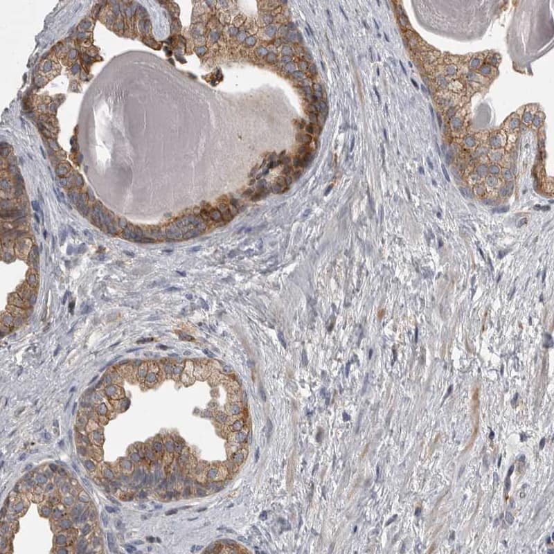 Staining of human prostate shows moderate membranous positivity in glandular cells.