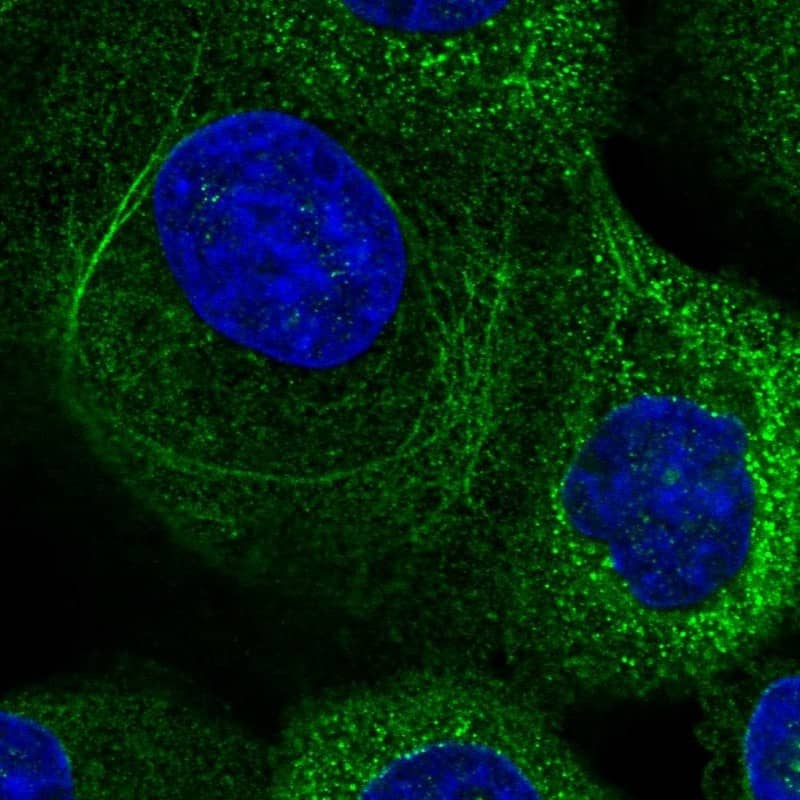 Staining of human cell line A-431 shows localization to cytosol & intermediate filaments.