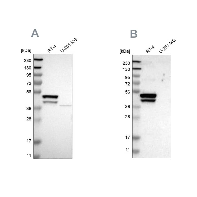 Western Blot KRT23 Antibody - BSA Free